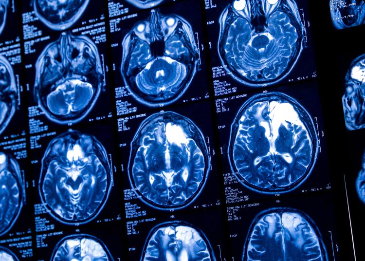 Pourquoi rendre la maladie mystérieuse ?